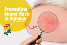Preventing Diaper Rash in Indian Summer: What Works Best